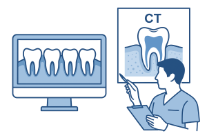 レントゲン／CT確認の図