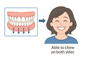 噛み合わせバランスが改善し左右で噛めるようになった様子